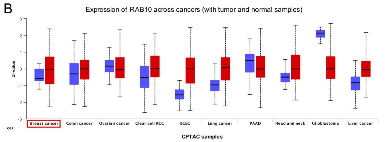 The UALCAN database shows a significant upregulation of RAB10 protein in BC.jpg